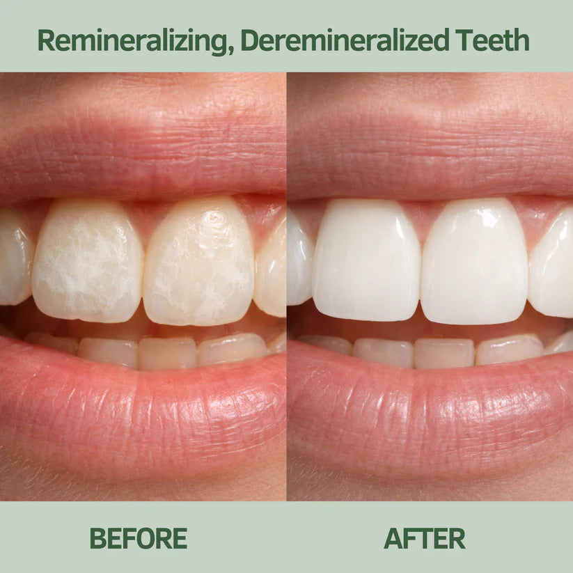 Cellvian™ Remineralizing Gum